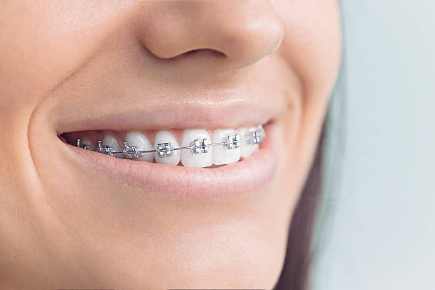 Full Mouth Reconstruction in Roy, UT
